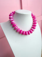 LOVE LEMON LANE | Chunky Marbled Rondelle Necklace - Hot Pink