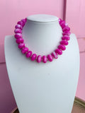 LOVE LEMON LANE | Chunky Marbled Rondelle Necklace - Hot Pink